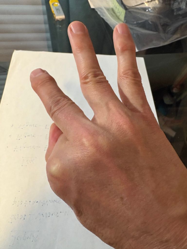 A hand making a 'three' gesture, with the index and middle fingers raised and the thumb tucked down.